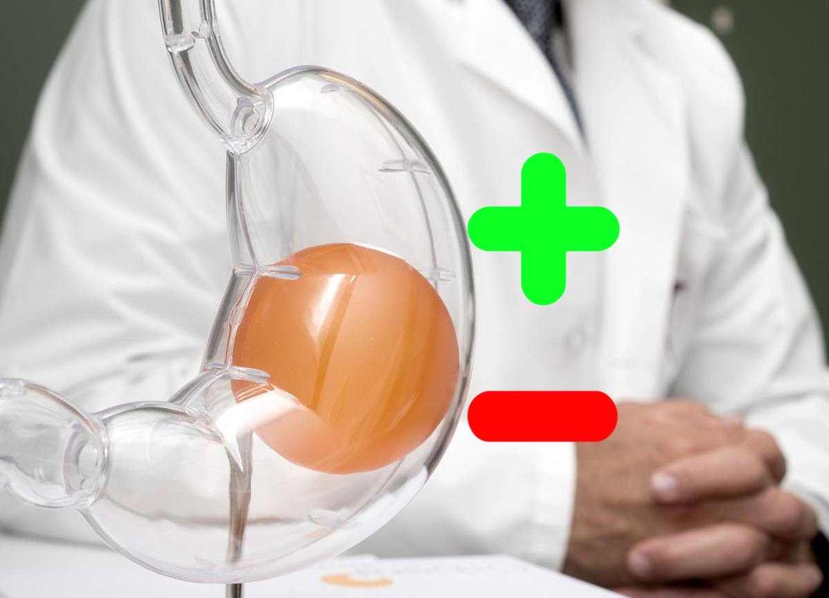 بهترین دکتر برای بالون معده 10 فواید و عوارض بالون معده