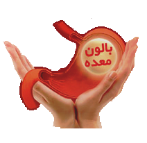 بالون معده-دکتر فرزاد فرامرزی
