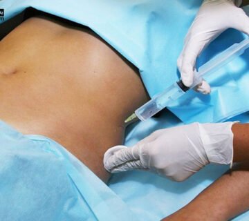 بوتاکس معده دکتر فرامرزی، فوق تخصص گوارش و آندوسکوپی