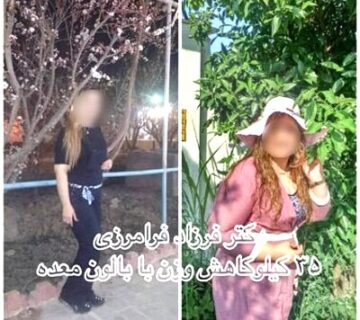 از بالن معده راضی بودین؟ جواب 1 بیمار دکتر فرزاد فرامرزی را در ادامه بخوانید 10 از بالن معده راضی بودین