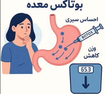 بوتاکس معده چند کیلو کم می کنی؟