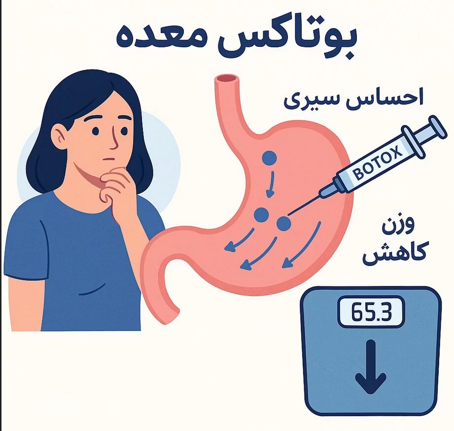 بوتاکس معده چند کیلو کم می کنید؟ 2 بوتاکس معده چند کیلو کم می کنی؟